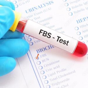 PLASMA LABS – FBS (Fasting Blood Sugar) Test