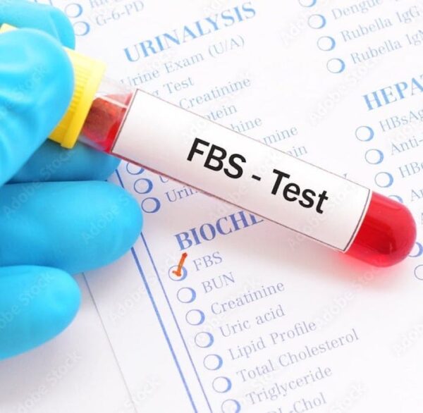 PLASMA LABS – FBS (Fasting Blood Sugar) Test