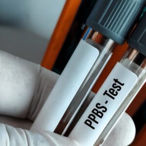 PLASMA LABS – PPBS (Postprandial Blood Sugar) Test