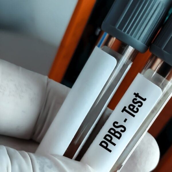 PLASMA LABS – PPBS (Postprandial Blood Sugar) Test