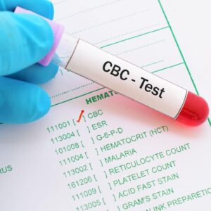 PLASMA LABS – CBC (Complete Blood Count) Test
