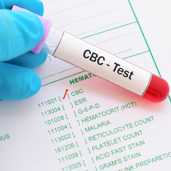 PLASMA LABS – CBC (Complete Blood Count) Test